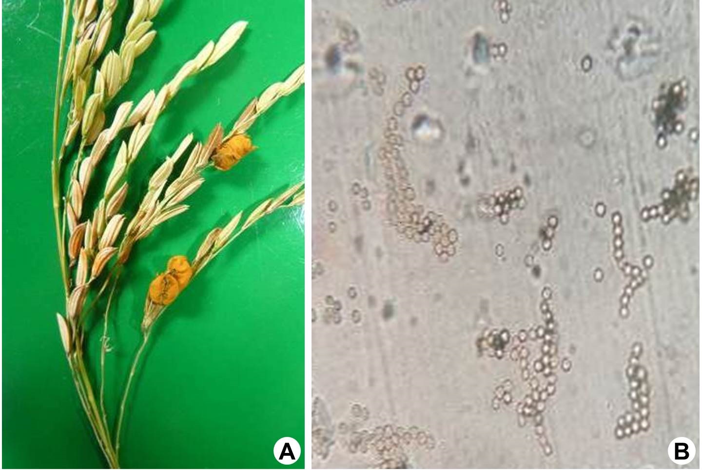 Symptoms and signs of false smut caused by Ustilaginoidea virens (Cooke) Takah. in rice panicle: A, Spore galls on panicle; B, Chlamydospores.