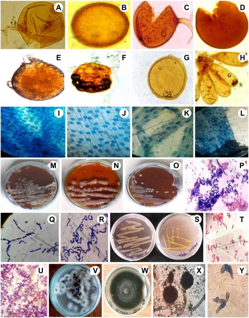 Microbial diversity of Rhizospheric soil samples of <em>Zephyranthes rosea </em>Lindl.:<strong> A</strong>,<strong> </strong><em>Gigaspora gigantia</em>; <strong>B</strong>,<strong></strong><em>Acaulospora bireticiulata</em>; <strong>C</strong>,<strong></strong><em>Glomus macrocarpum</em>; <strong>Dâ€“E</strong>,<strong></strong><em>Glomus </em>sp.; <strong>F</strong>,<strong></strong><em>Sclerocystis coccogena</em>; <strong>G</strong>,<strong></strong><em>Glomus mosseae</em>; <strong>H</strong>,<strong></strong><em>Sclerocystis sinuosus</em>; <strong>Iâ€“L</strong>,<strong></strong>AM Fungal Infection; <strong>Mâ€“O</strong>,<strong></strong><em>Streptomyces </em>spp. onto culture medium <strong>Pâ€“R</strong>,<strong></strong>Microscopic images of <em>Streptomyces </em>spp.; <strong>S</strong>,<strong></strong><em>Bacillus </em>spp. on Nutrient Agar; <strong>T</strong>,<strong></strong>Microscopic view of <em>Streptobacillus </em>sp.; <strong>U</strong>, Microscopic image of <em>Bacillus </em>sp. <strong>Vâ€“W</strong>,<strong></strong><em>Aspergillus niger </em>and <em>Alternaria zinniae </em>on culture medium; <strong>Xâ€“Y</strong>,<strong></strong>Microscopic images of <em>Aspergillus niger </em>and <em>Alternaria zinniae</em>.